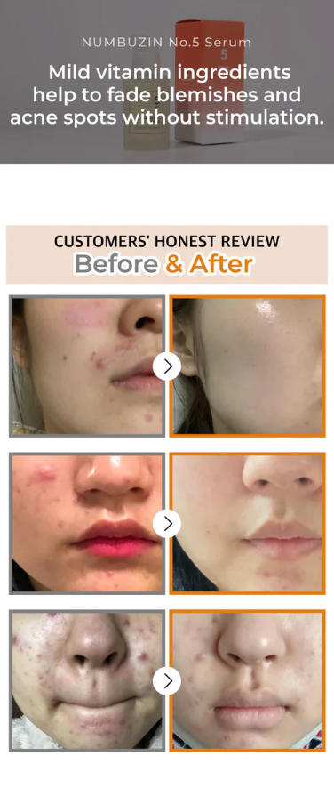 Numbuzin No.5 Goodbye Blemish Serum – με βιταμίνης C νιασιναμίδη 50ml - Image 2